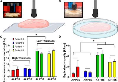 Characterizing viscoelastic properties of human melanoma tissue using Prony series